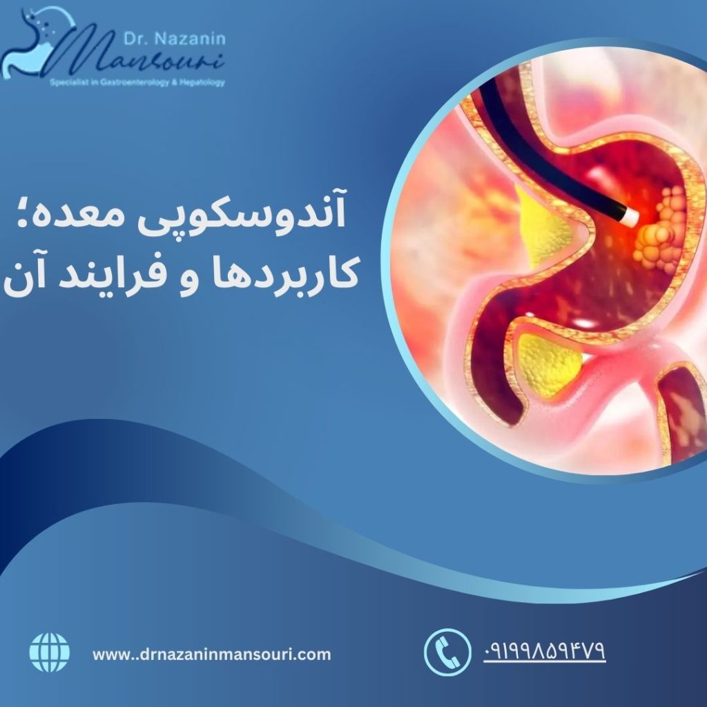 آندوسکوپی معده 