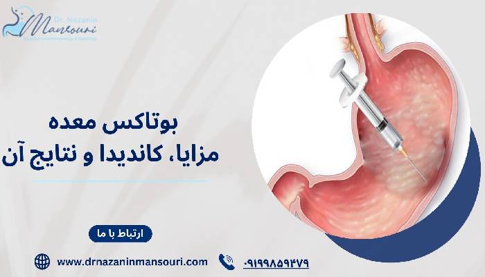 بوتاکس معده