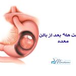 مراقبت های بعد از بالن معده