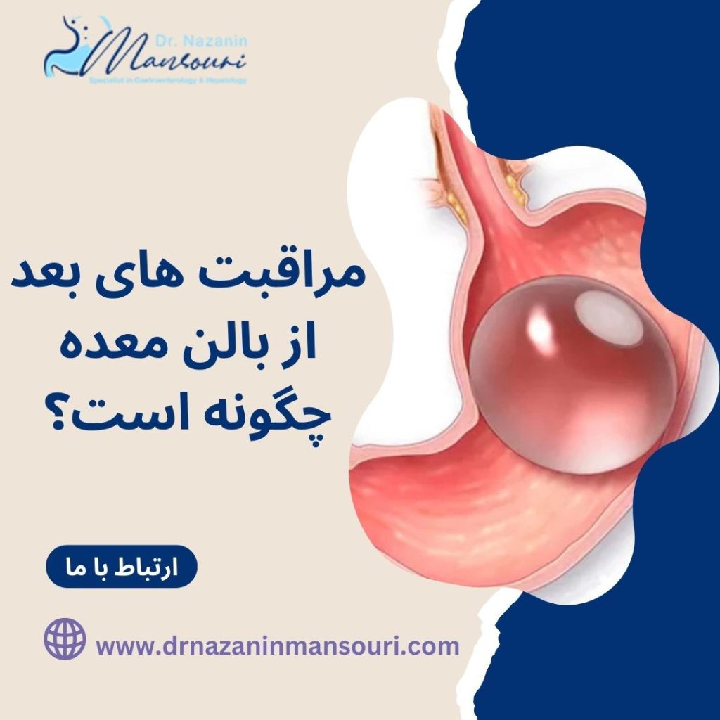 مراقبت های بعد از بالن معده