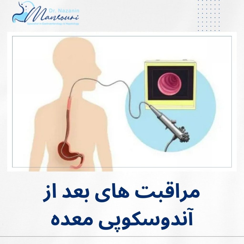 مراقبت‌ های بعد از آندوسکوپی معده