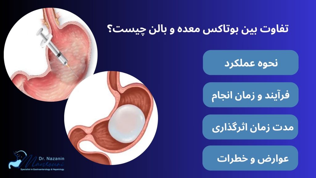 بوتاکس بهتر است یا بالن معده