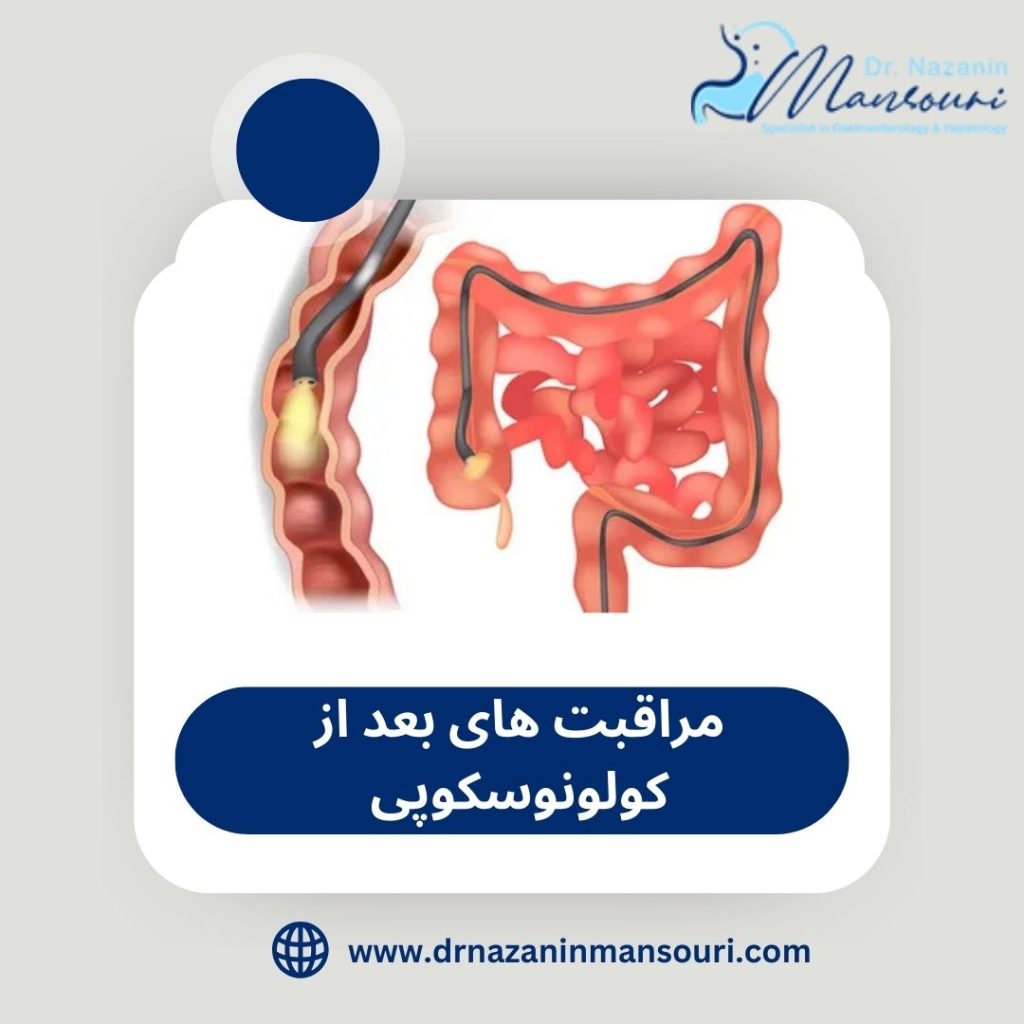 مراقبت های بعد از کولونوسکوپی 
