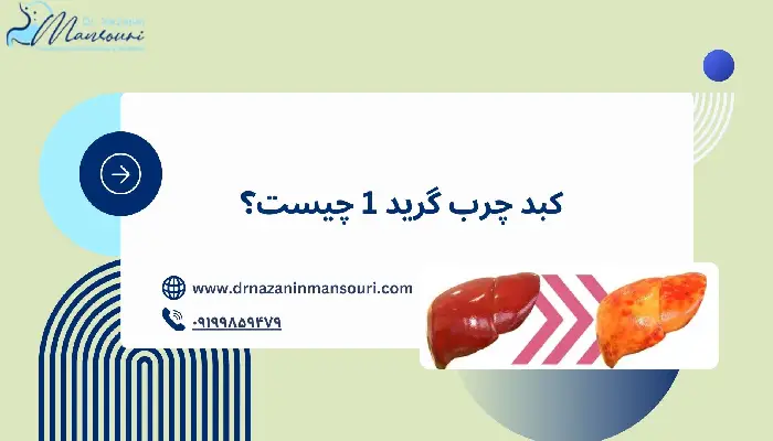 کبد چرب گرید 1