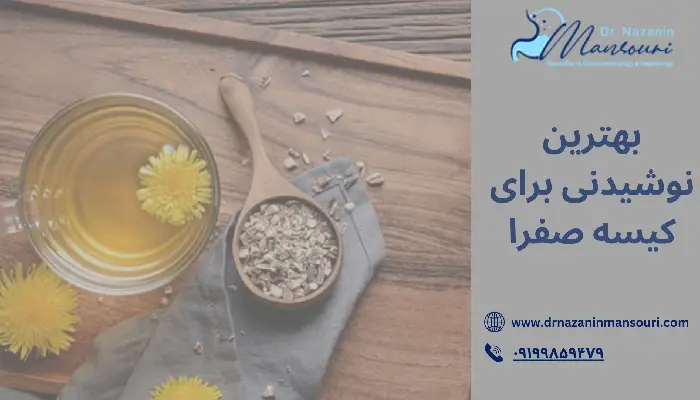 بهترین نوشیدنی برای کیسه صفرا