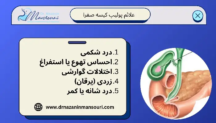  پولیپ کیسه صفرا