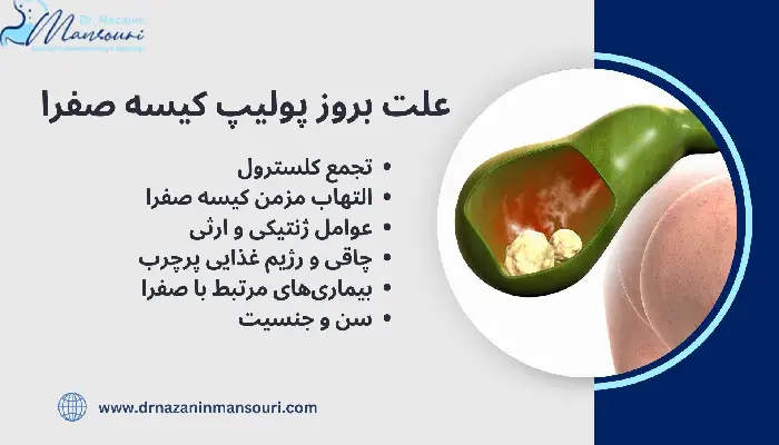  پولیپ کیسه صفرا