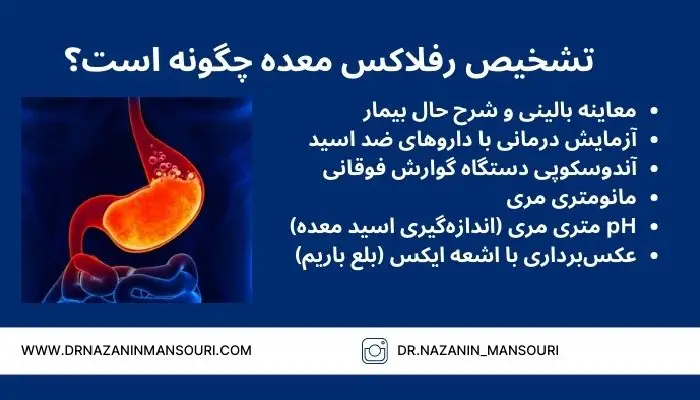 رفلاکس معده