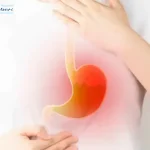 رفلاکس معده