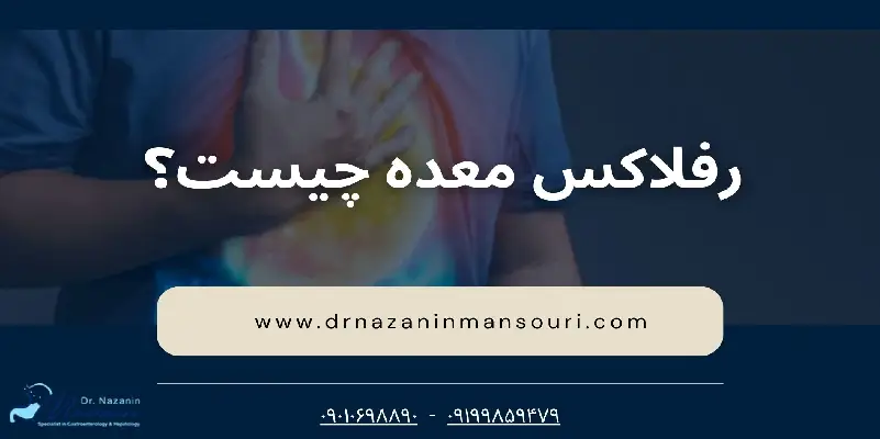 رفلاکس معده