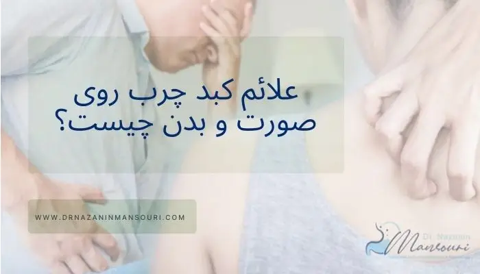 علائم کبد چرب روی پوست