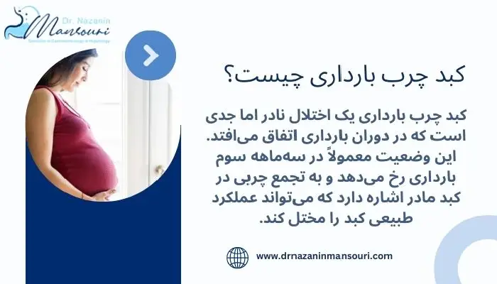 کبد چرب بارداری