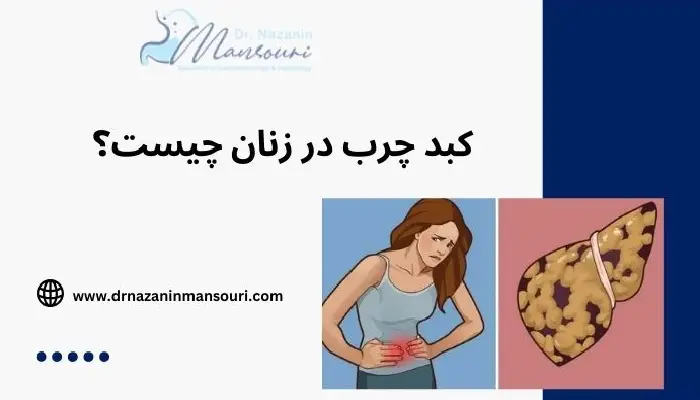 کبد چرب در زنان