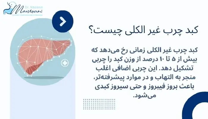 کبد چرب غیر الکلی 
