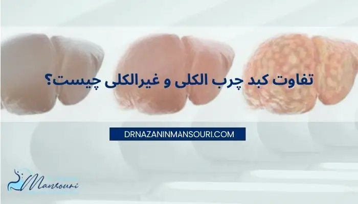 تفاوت کبد چرب الکلی و غیرالکلی