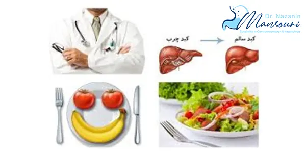 رژیم غذایی کبد چرب