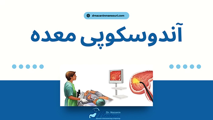 آندوسکوپی معده