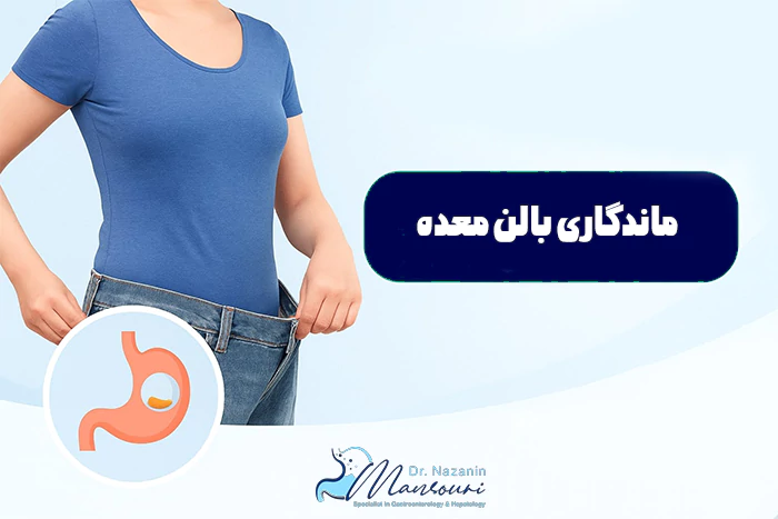 ماندگاری بالن معده چقدره؟