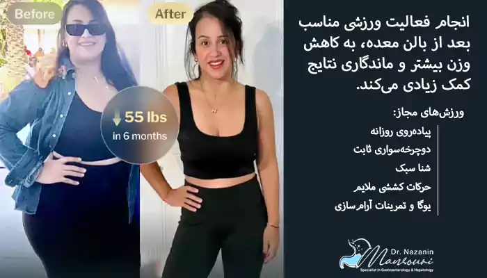 ورزش کردن بعد از بالن معده