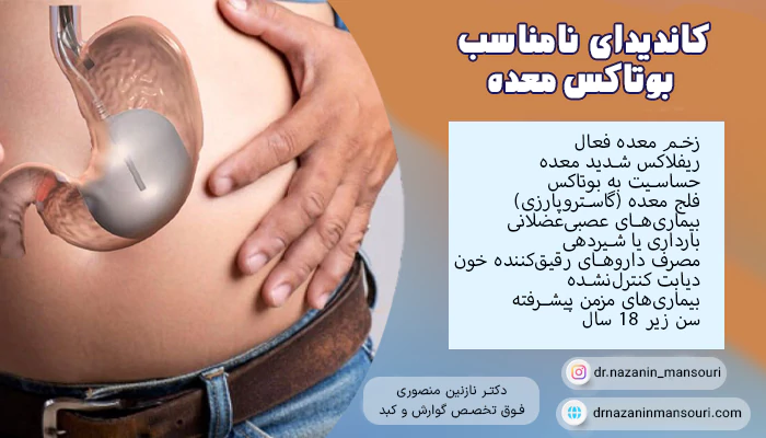 کاندیدا نا مناسب بوتاکس معده