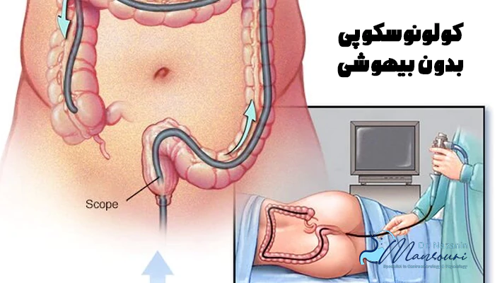 کولونوسکوپی بدون بیهوشی چطوریه؟