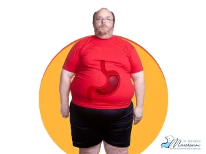 بالن معده چقدر وزن کم میکند